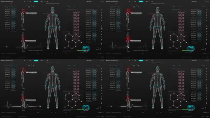 未来的医疗保健和生物技术概念:医学研究环境软件模板与化学式和女性身体扫描结果的计算机显示器和笔记本电