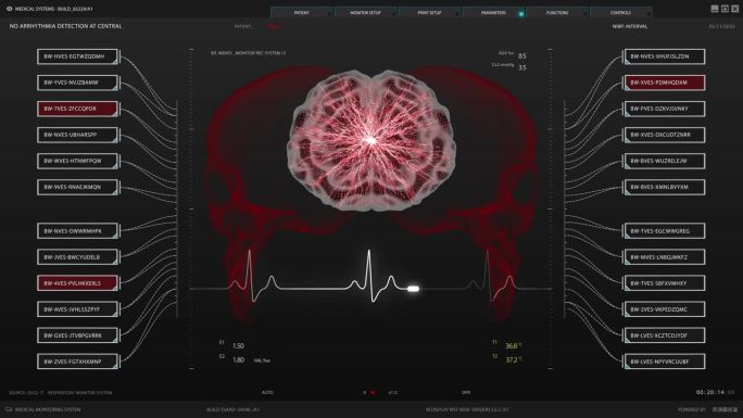 健康监测医疗软件接口的医生和诊所。用大脑活动监测3D模型代替暗屏。重要器官可视化的用户界面