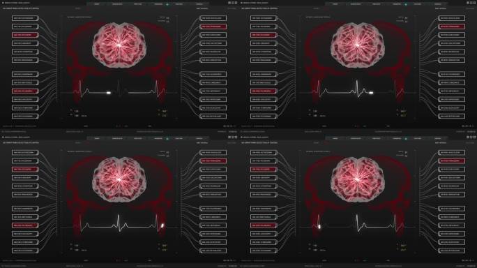 健康监测医疗软件接口的医生和诊所。用大脑活动监测3D模型代替暗屏。重要器官可视化的用户界面