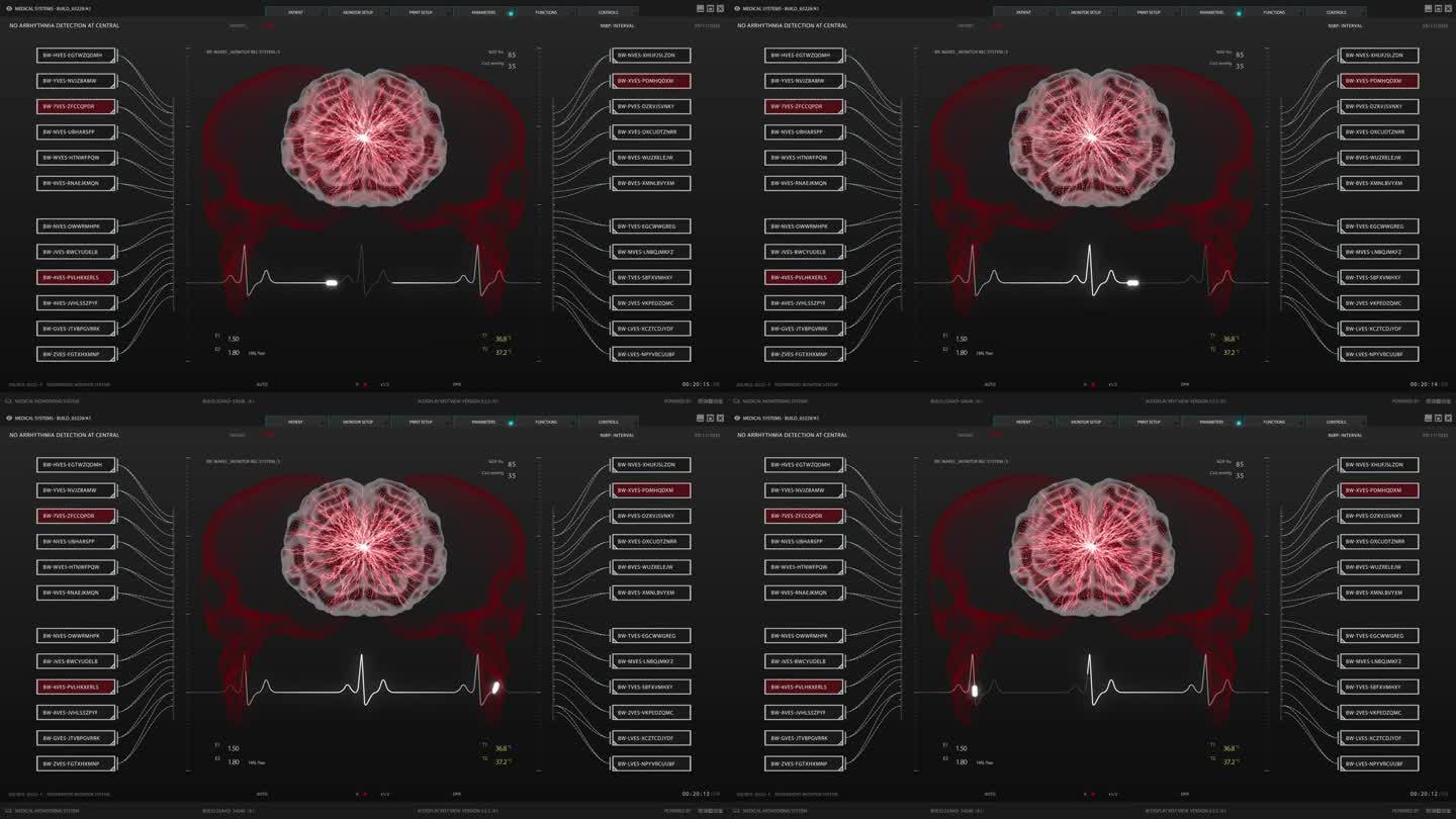 健康监测医疗软件接口的医生和诊所。用大脑活动监测3D模型代替暗屏。重要器官可视化的用户界面
