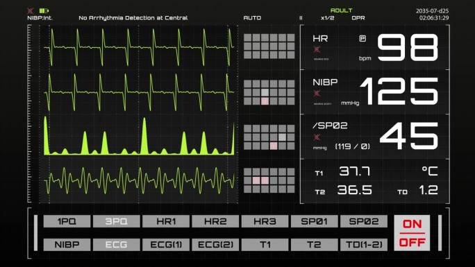 生命体征监视器与心率和其他医疗参数的动画模型。重症监护病房的病人生命体征和心电图模板，用于计算机显示