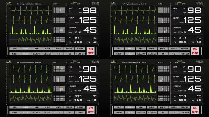 生命体征监视器与心率和其他医疗参数的动画模型。重症监护病房的病人生命体征和心电图模板，用于计算机显示