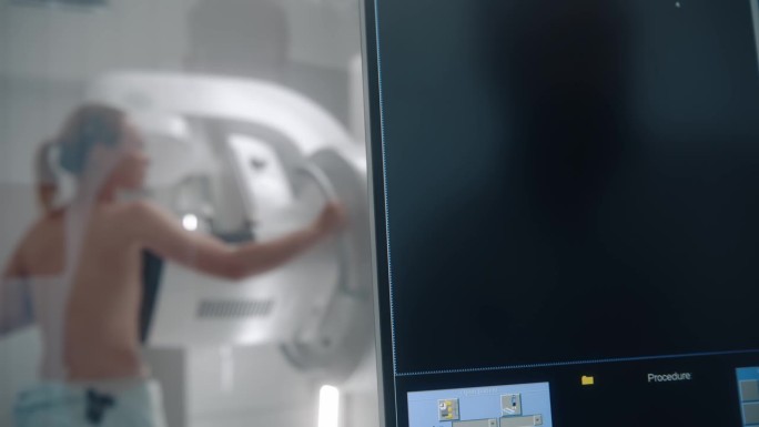 计算机控制面板屏幕乳房x光扫描成像