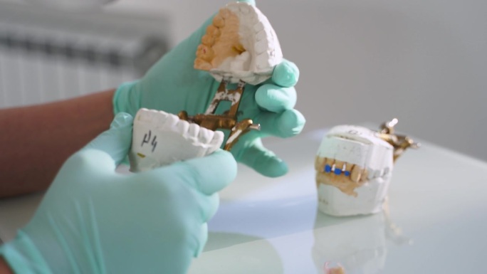 牙科技师在口腔实验室用手检查义齿质量。现代口腔科办公室，女牙医在制作假牙时拿着石膏模型。假牙科。特写