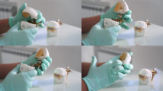 牙科技师在口腔实验室用手检查义齿质量。现代口腔科办公室，女牙医在制作假牙时拿着石膏模型。假牙科。特写