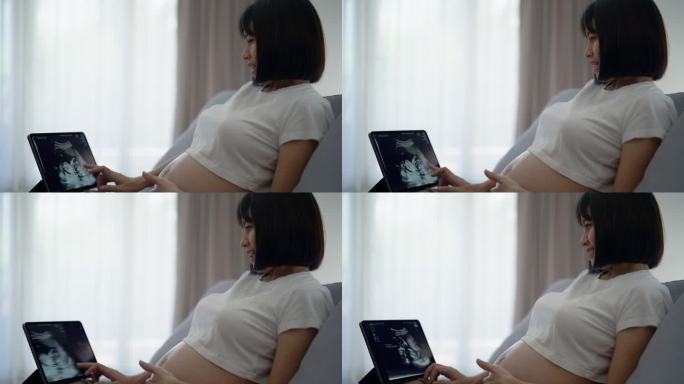 年轻的怀孕母亲高兴地看着平板上的超声波片，一边打电话给医生。