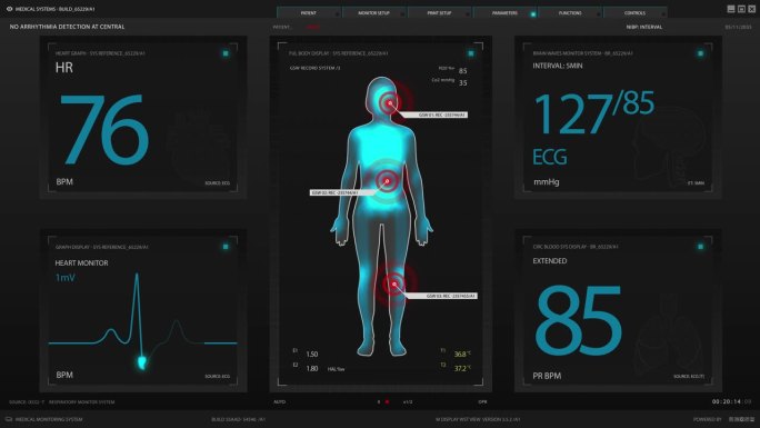 模拟屏幕模板:软件显示医院女病人接受手术的重要活动。未来的身体扫描显示医疗干预期间的健康紧急情况