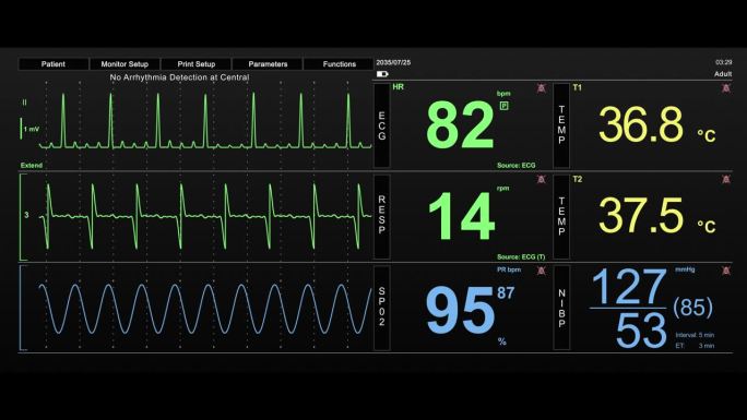 生命体征监视器与心率和其他医疗参数的动画模型。重症监护病房的病人生命体征和心电图模板，用于计算机显示