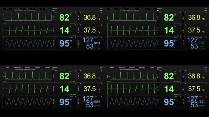 生命体征监视器与心率和其他医疗参数的动画模型。重症监护病房的病人生命体征和心电图模板，用于计算机显示