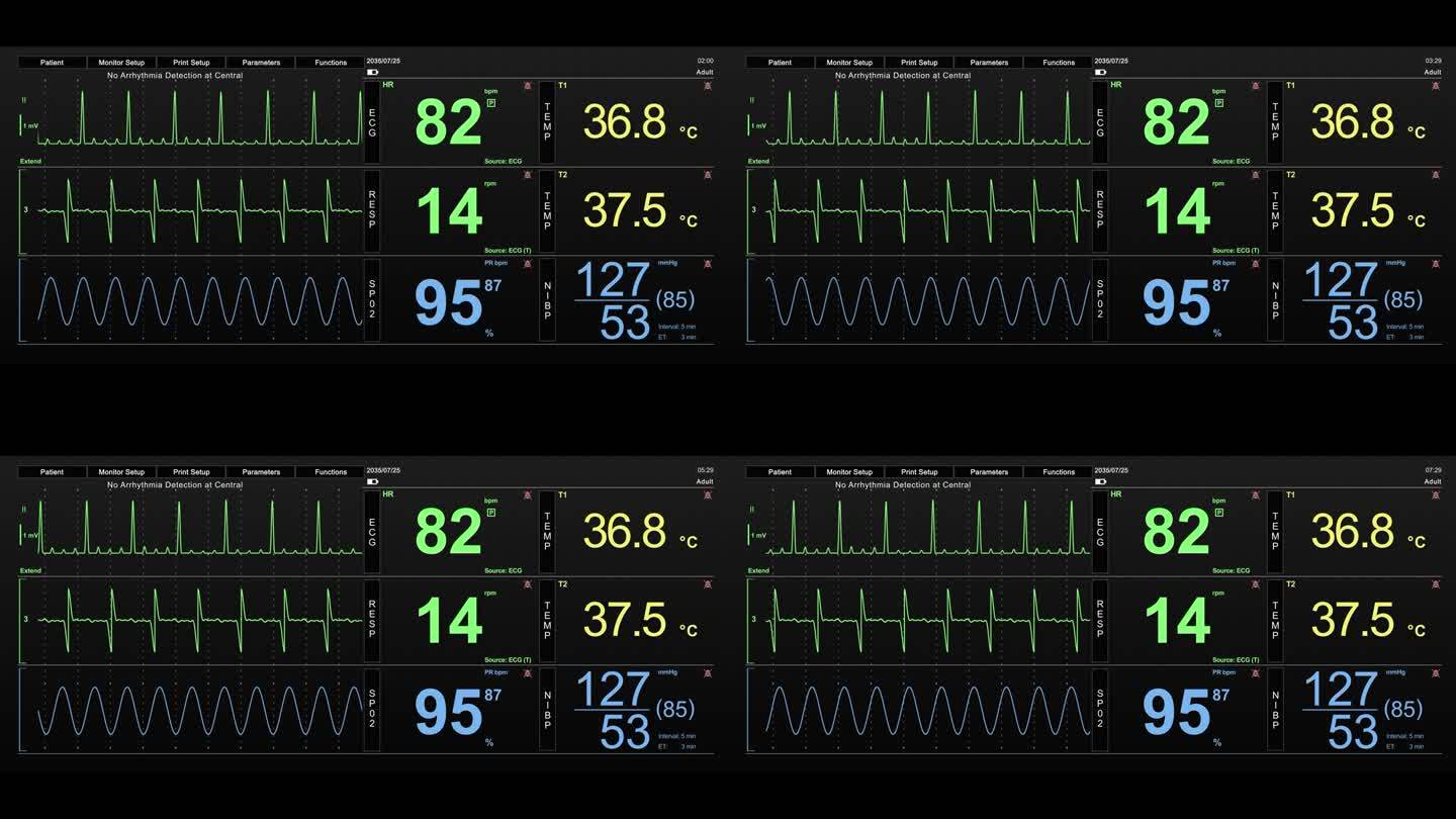 生命体征监视器与心率和其他医疗参数的动画模型。重症监护病房的病人生命体征和心电图模板，用于计算机显示