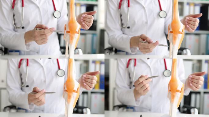 医生展示了膝关节的解剖模型