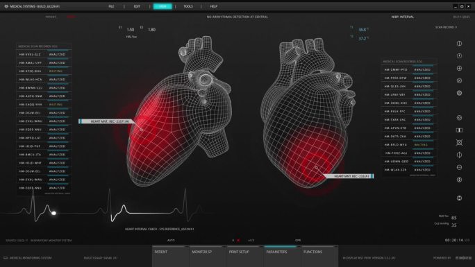 健康监测医疗软件接口的医生和诊所。深色屏幕替换心脏活动监测3D模型。重要器官可视化的用户界面