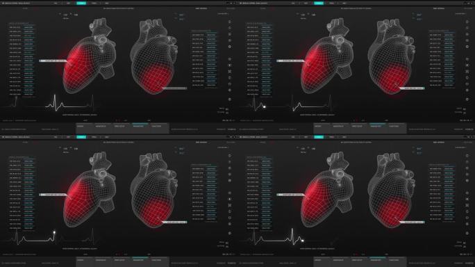 健康监测医疗软件接口的医生和诊所。深色屏幕替换心脏活动监测3D模型。重要器官可视化的用户界面