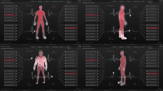 模拟屏幕模板:显示医院接受手术的男性病人的重要活动的软件。未来的身体扫描显示医疗干预期间的健康紧急情