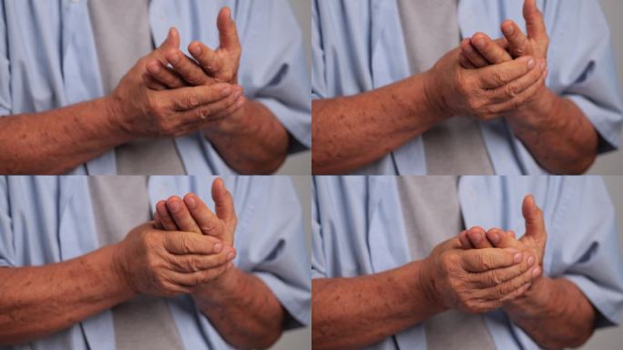一名亚洲男子的手有刺痛感和麻木感，这导致了脚气病。