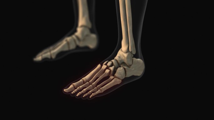 跖骨和指骨骨痛的医学动画