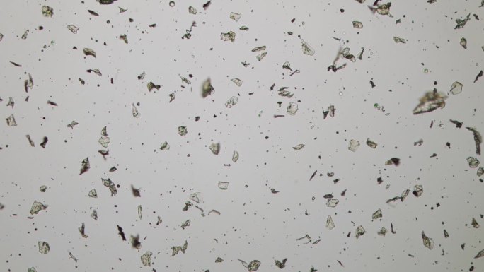 典型公寓里的灰尘。显微镜下的微粒——皮肤鳞片、头发、衣服纤维、纸片、有机和无机元素、过敏原、花粉、螨