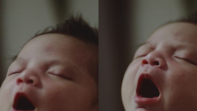 婴儿呼吸系统竖屏发育不良