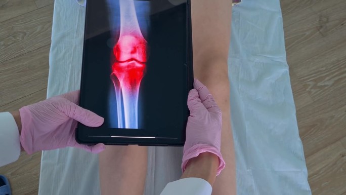 创伤学家检查小女孩腿部的x光片和膝盖的炎症