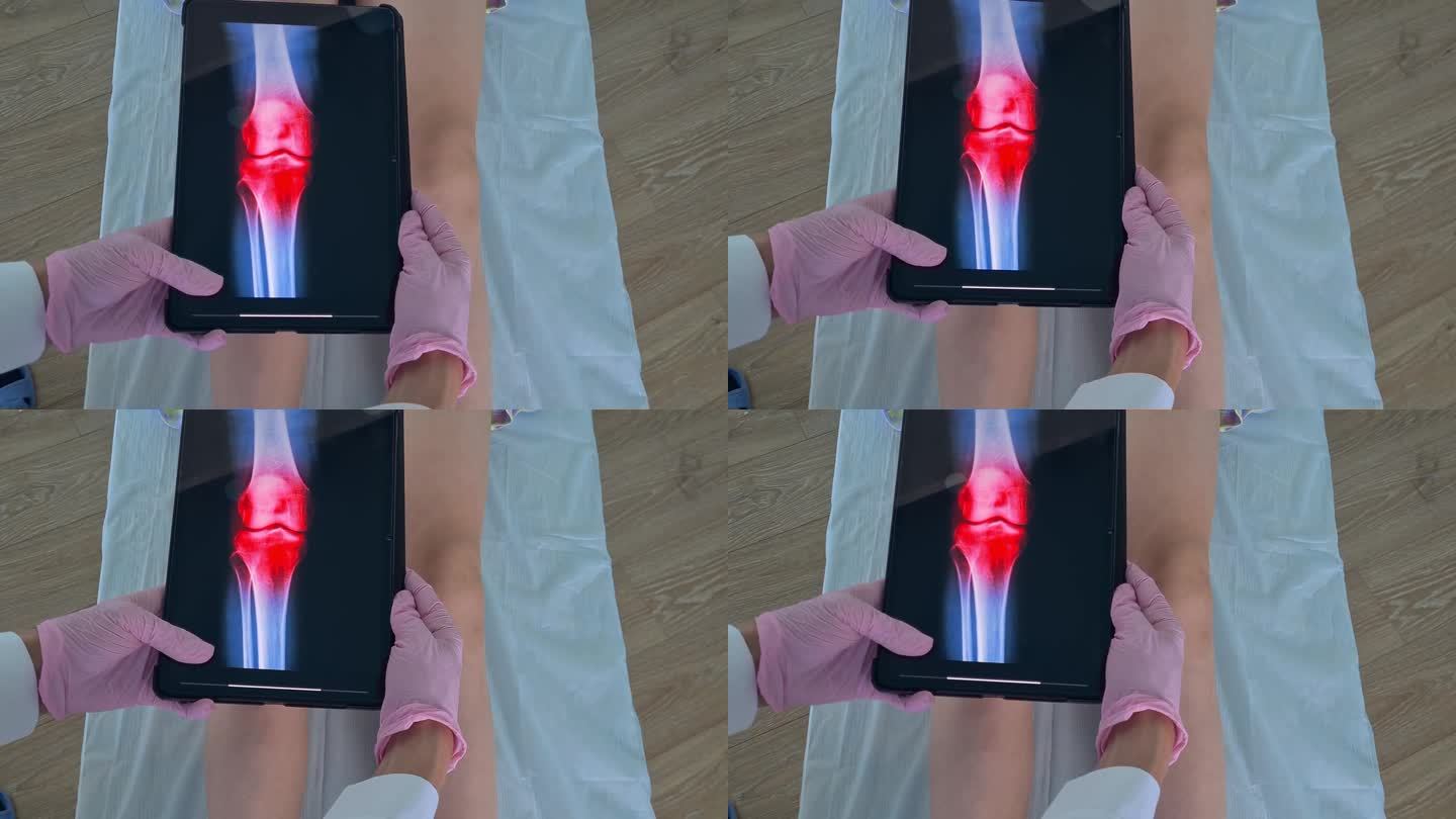 创伤学家检查小女孩腿部的x光片和膝盖的炎症