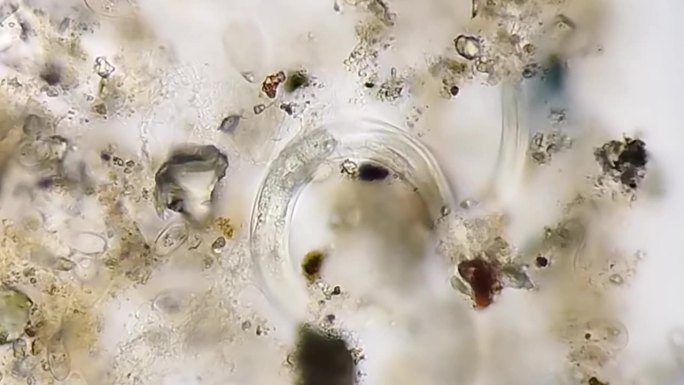 血吸虫科。显微镜下人类尿液标本中的寄生虫。尿寄生虫