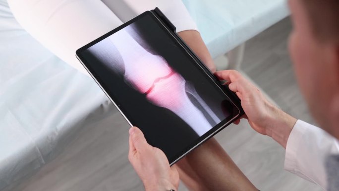 伤科医生用数码平板电脑扫描女性膝关节特写4k电影慢动作