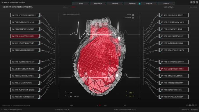 健康监测医疗软件接口的医生和诊所。深色屏幕替换心脏活动监测3D模型。重要器官可视化的用户界面