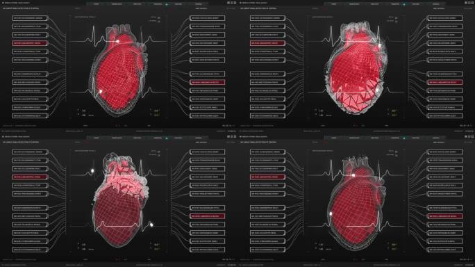 健康监测医疗软件接口的医生和诊所。深色屏幕替换心脏活动监测3D模型。重要器官可视化的用户界面