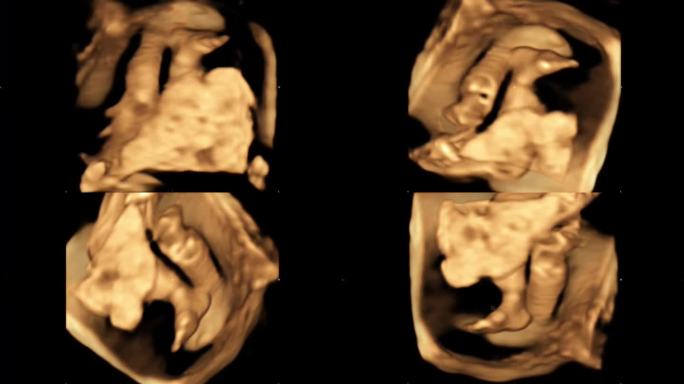 胎儿在母体子宫内的4D超声运动。人生观念，科学发现
