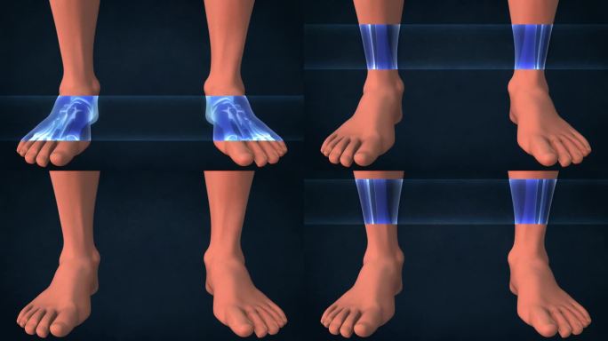 人脚的x光片