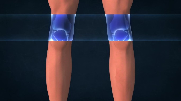 人类膝盖的x光片。