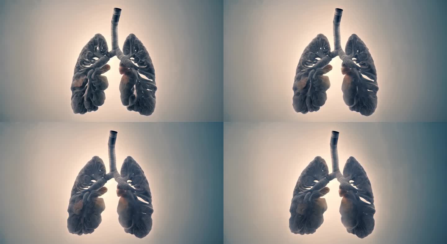 人体内部肺部扫描图