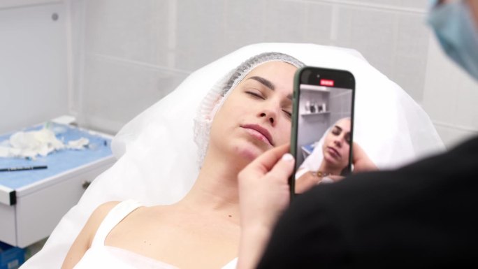 美容师用手机拍摄客户面部比例的照片。前后的结果。美容诊所。美容注射，手术服务。