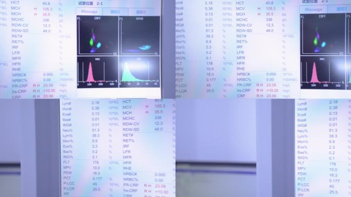 医院检验科正在运行的临床检验分析仪器