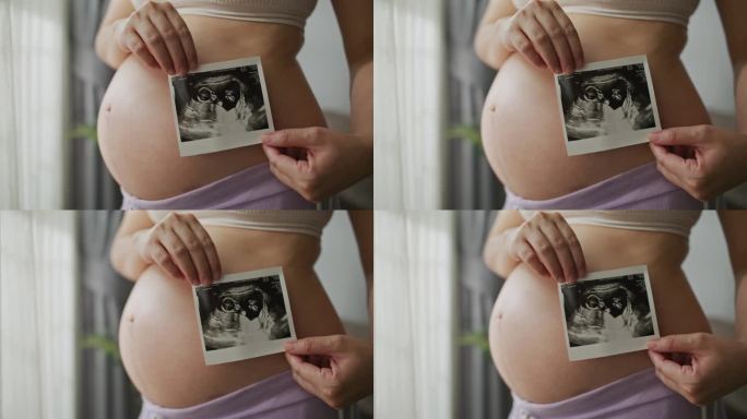 孕妇对着相机拿着超声波扫描