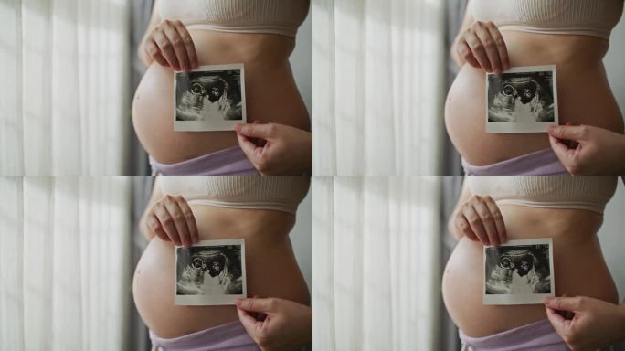 孕妇与婴儿的超声波图像特写