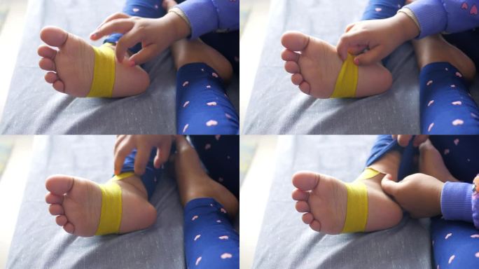 弹性治疗黄色胶布应用于儿童腿部。