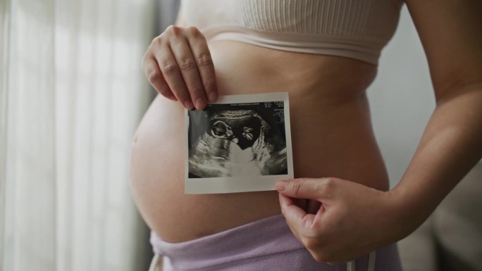 孕妇对着相机拿着超声波扫描
