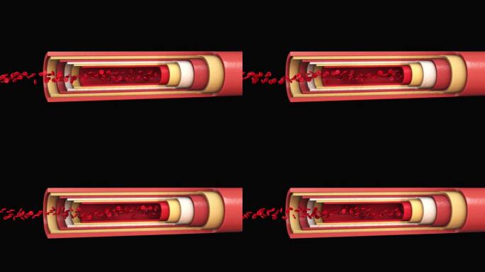 红细胞在动脉内流动