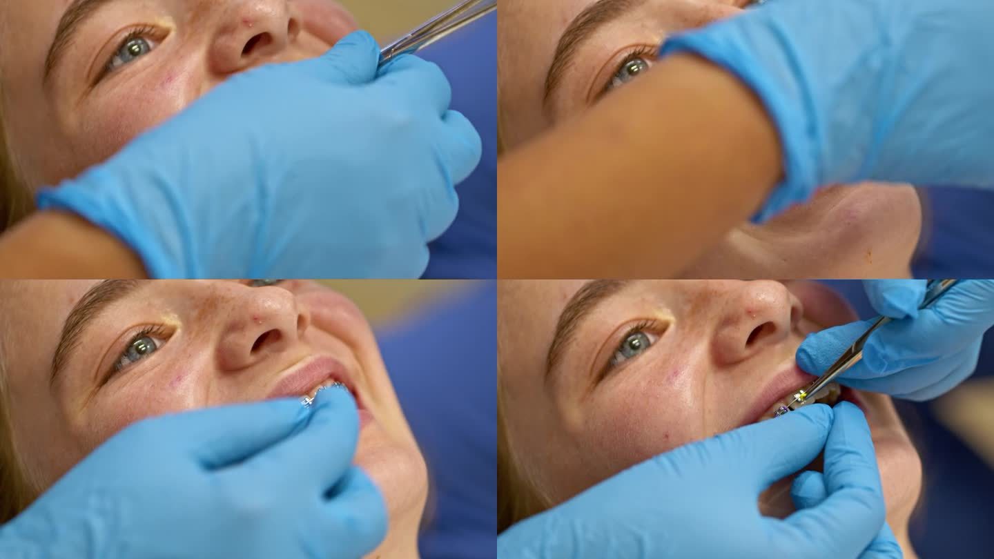 安装新橡皮筋外国妇女看牙医