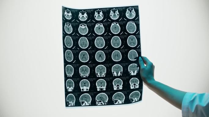 x光，头部磁共振图像。医生检查人脑核磁共振特写。先进的身体研究，检查断层扫描。