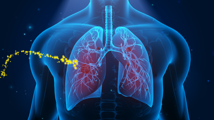 4K 人体器官 肺癌恢复健康