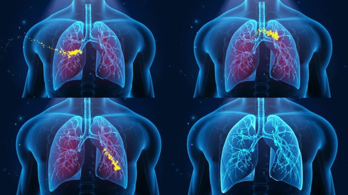 4K 人体器官 肺癌恢复健康