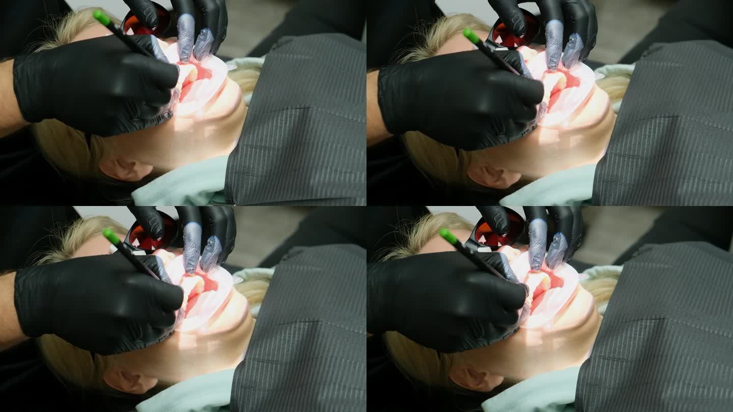 医生用铅笔在病人的牙齿上做记号。