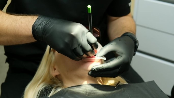牙医用医用镊子取出病人的牙模。