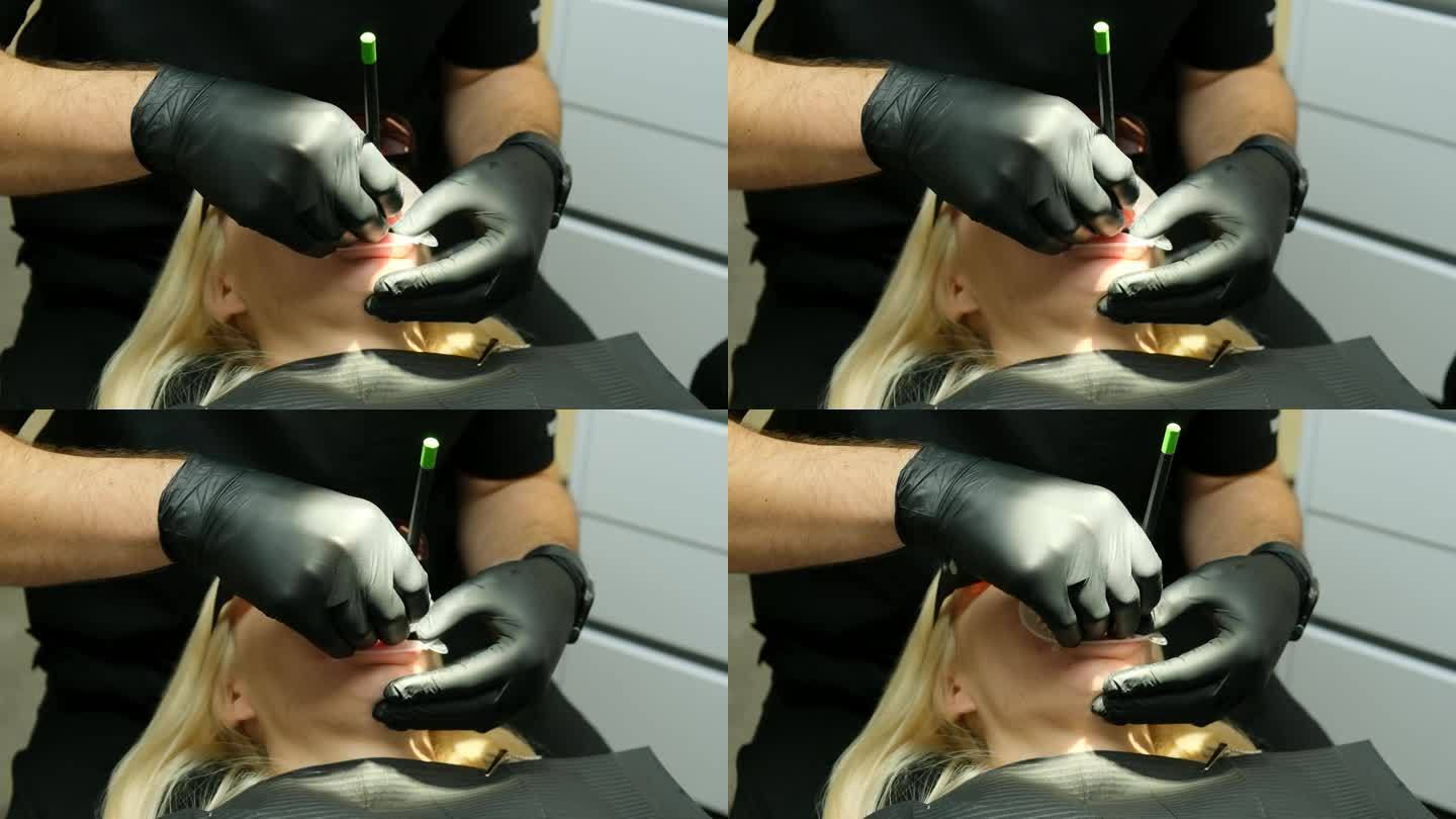 牙医用医用镊子取出病人的牙模。