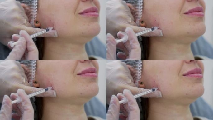 美容师在年轻美女的颧骨上注射肉毒杆菌。极致的近距离4k拍摄