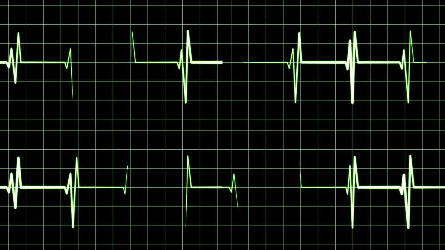 显示心率的心电图，医院的诊断设备，心跳，正常脉搏，医学检查，重症监护病房的生命体征数据屏幕，生命，