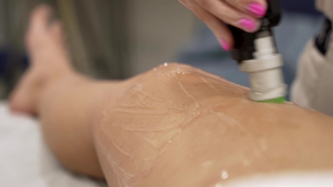 专业美容师在美容院为年轻女性做激光腿部脱毛，身体护理脱毛治疗的特写视频。