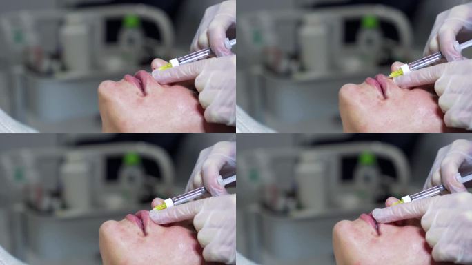 美容师医生在年轻漂亮的女人的嘴唇上注射肉毒杆菌。极致的近距离4k拍摄